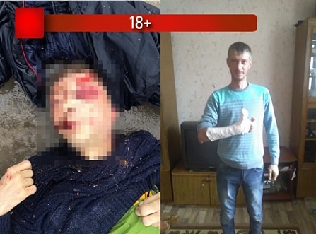 Подозрительная смерть двух шахтинцев в Московской области шокировала результатами медэкспертизы